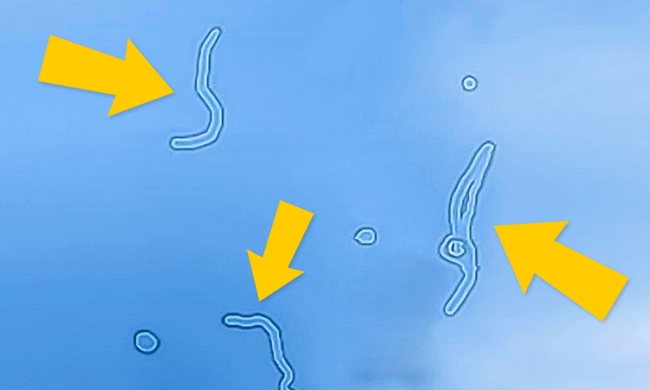 Ko’zimiz atrofida suzib yuruvchi shaffof narsalar qayerdan paydo bo’ladi?