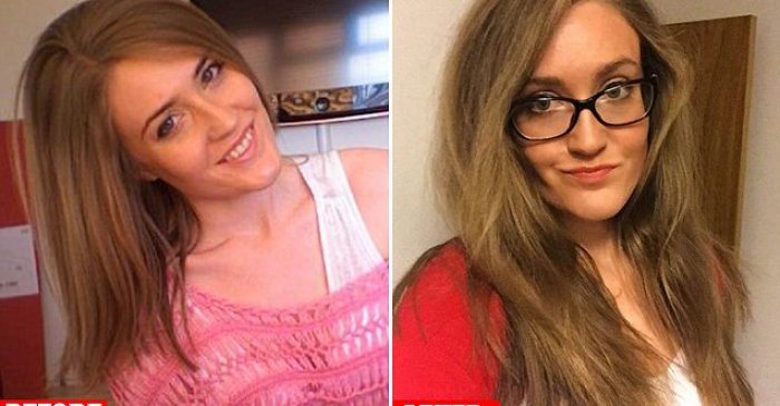 Britaniyalik ayol sochni bir yil shampunda yuvmaslik oqibatini o'z boshida sinab ko'rdi