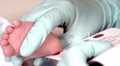 O`zbekistonda 17 yilda 4,8 milliondan ziyod chaqaloq neonatal skrining tekshiruvidan o`tkazildi