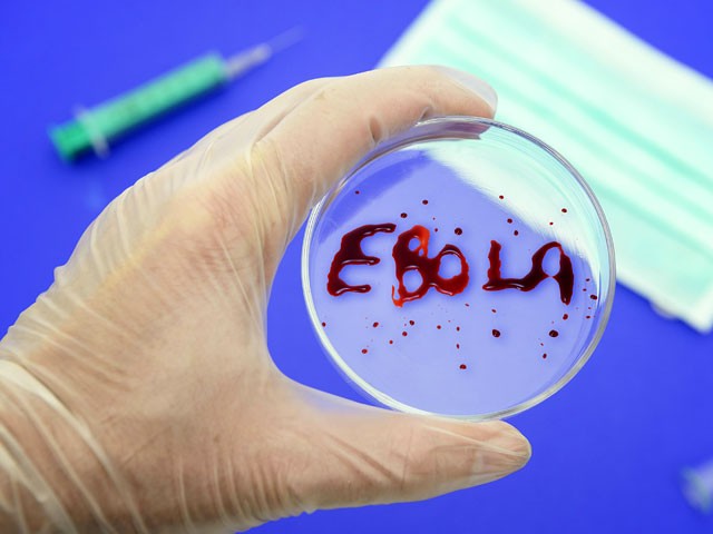 Gvineyada Ebola virusidan to‘rt kishi halok bo‘ldi