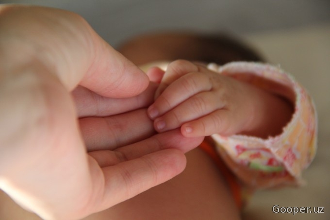 Qozog‘istonda “kapalak sindromi” bo‘lgan qizcha dunyoga keldi